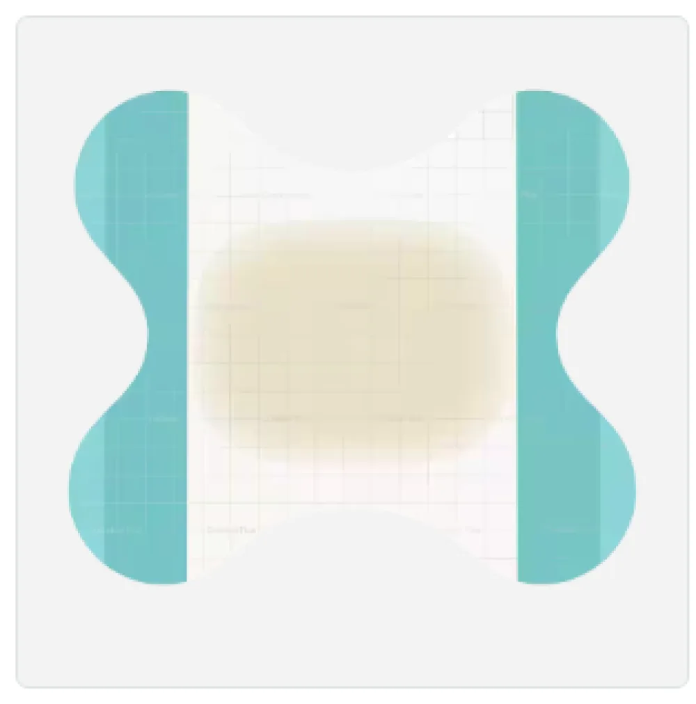 Coloplast Comfeel® Plus Contour – Aljinat Katkılı Hidrokolloid Yara Örtüsü (Özel Kesim)